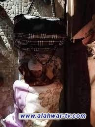 العثور على طفلة معنفة من قبل والدها في شوارع واسط